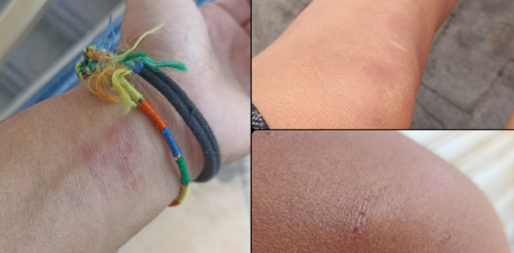 relazione gay della figlia, accoltella lei e la compagna