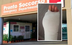 Vergogna in ospedale, napoletana si rompe il tendine di una mano, i medici di Roma la insultano: “E’ una sceneggiata!