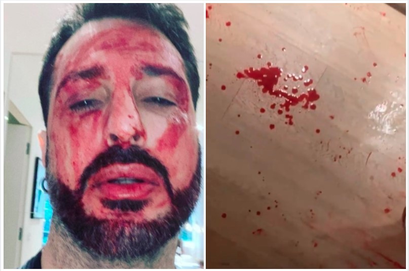 Fabrizio Corona disperato, minaccia di uccidersi: "E' solo l'inizio, davvero mi taglio la vita"