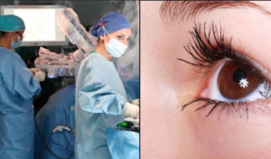 Trapianto di cornea a Pozzuoli