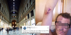 Questo è il risultato per aver difeso la mia CITTÀ , la mia casa, il quartiere dove vivo. Ieri sera sono stato aggredito da Mustafa, un parcheggiatore abusivo, che opera nel quadrilatero del centro, che è un senza fissa dimora, con precedenti e molto probabilmente con un decreto di espulsione. Dopo la partita ieri sera era ormai tardi verso 1:20 stavo andando a buttare la spazzatura, quando chi mi conosce, sa quanto odio il degrado che incombe nella città, mentre stavo filmando la situazione dello schifo che c'è all'interno della galleria Umberto I si è avvicinato il nostro caro mustafa infastidito si avvicina a dirmi "tu nn puó fare vidii perché privacy" Io gli dico quale privacy inizia la discussione che loro qui all'interno della galleria si comportano male incivilmente pisciando a terra e cagando e che si devono comportare meglio. Lui simula di prendere qualcosa dalla tasca, facendomi credere di avere un arma o qualcosa per potermi intimorire, dato che non aveva nulla è corso a prendere una bottiglia da 66cl sul gomito spaccandosi e lacerandomi il gomito, forse, se fosse stata la testa?
