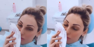 Cosa è successo ad Anna Tatangelo? La foto con il volto gonfio