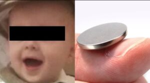 Bambino di un anno ingoia la batteria di un orsacchiotto e muore con un buco nel cuore