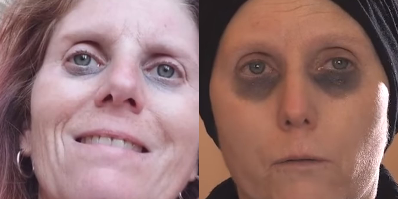 daniela infermiera malata di tumore