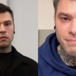 fedez condizioni