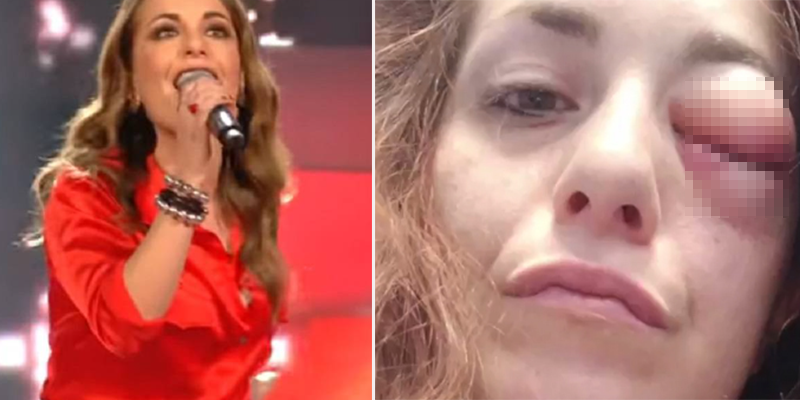 giuliana danzè picchiata