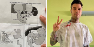 qual è il tumore trovato a fedez