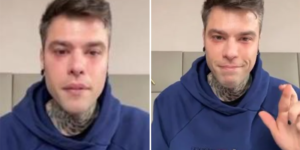 qual è malattia fedez