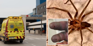 ragno violino puntura