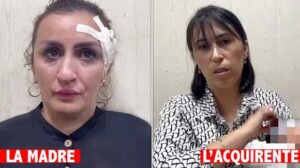 Mamma vende figlio per rifarsi il naso