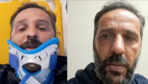 Rissa Villaricca-Carinola