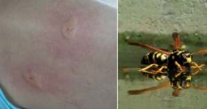 Napoli, calabrone asiatico punge uomo sul motorino: "Aiutatemi", poi la corsa in ospedale