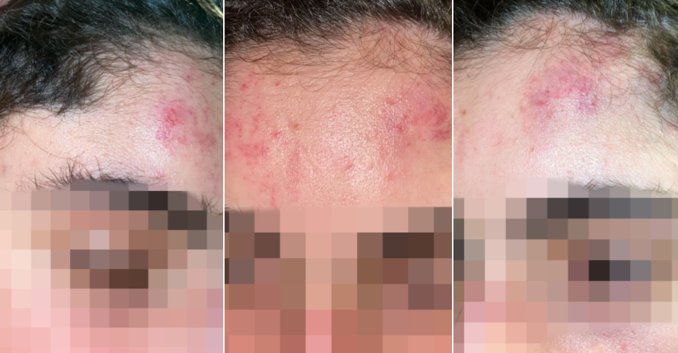 Ragazzini pestati a Napoli