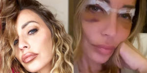 karina cascella chirurgo estetico